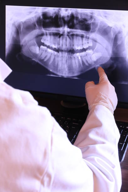 Best Emergency Wisdom Teeth Removal in Crestwood, IL