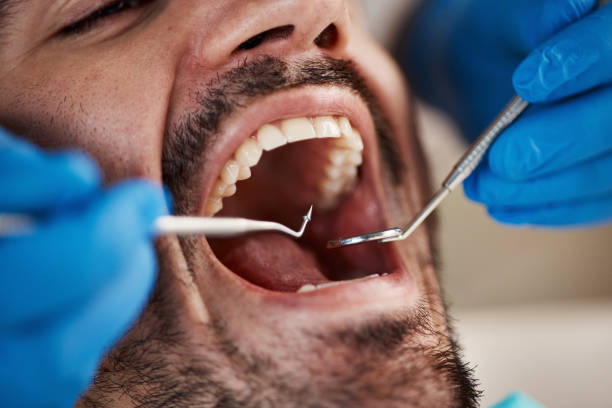 Best Emergency Gum Treatment in Crestwood, IL