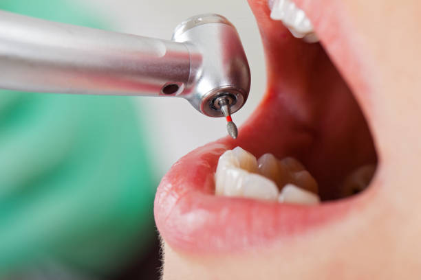 Best Emergency Tooth Extraction in Crestwood, IL